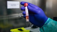 Coronavirus, il test da 25 euro che scopre positività in 15 minuti