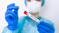 Nuovi tamponi Coronavirus, test veloce: come funzionano e chi ha la precedenza