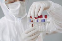 Vaccino Covid: studio e sperimentazione troppo brevi? La risposta dell'Aifa